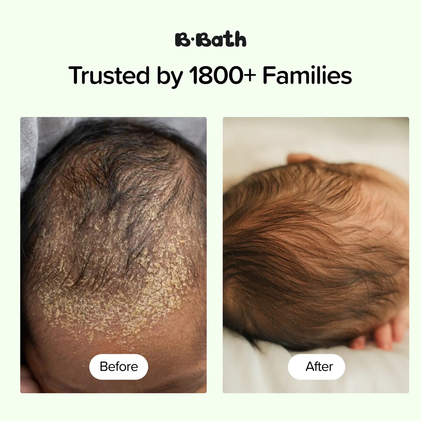 Soothing Dry Scalp Bundle