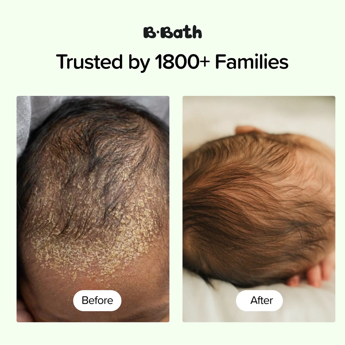 Soothing Dry Scalp Bundle