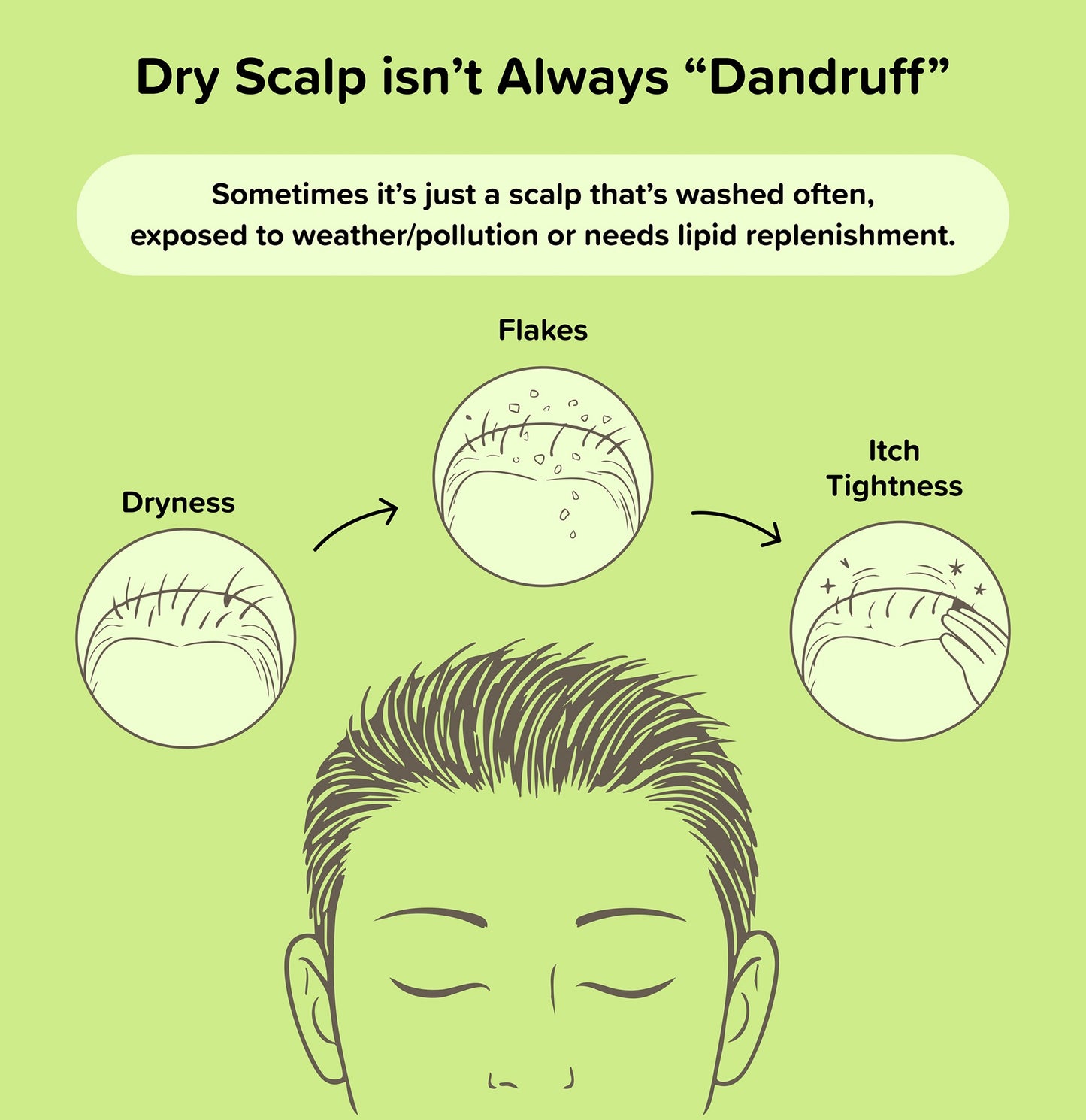 Soothing Dry Scalp Bundle