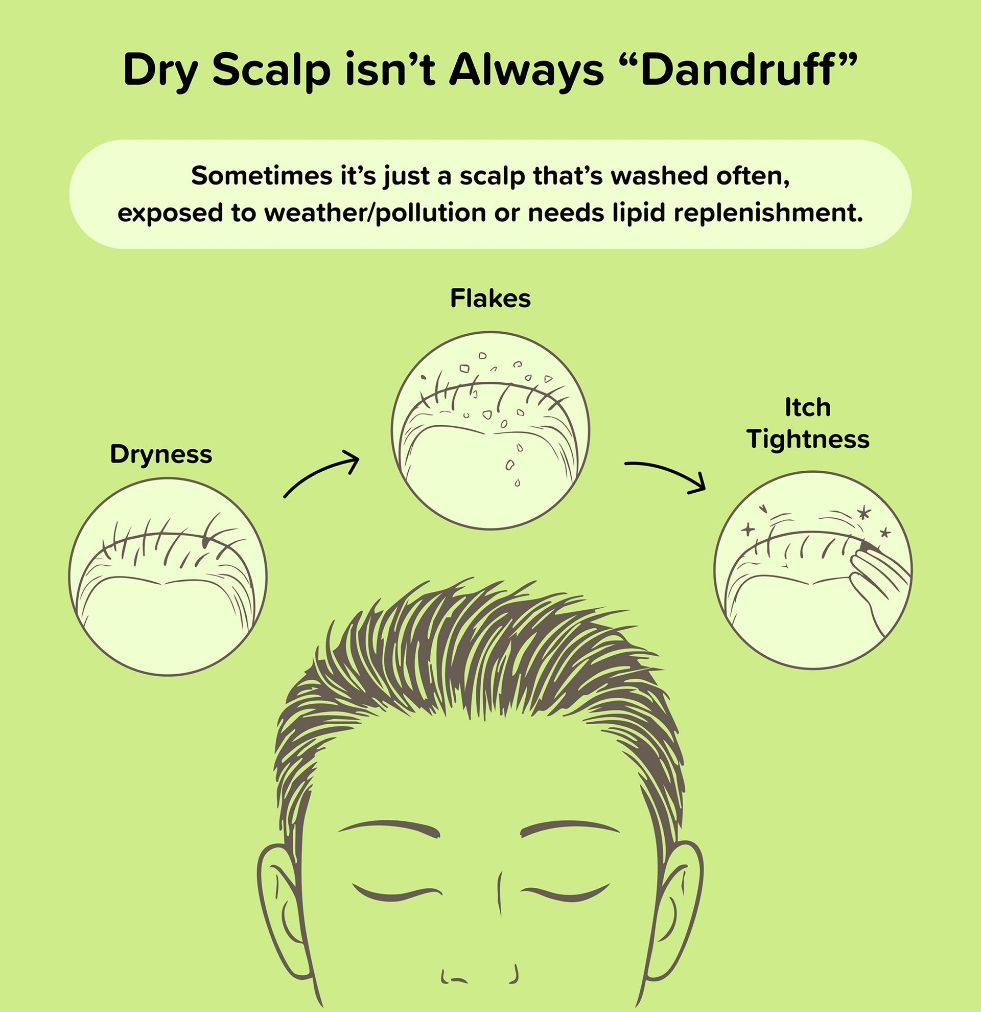 Soothing Dry Scalp Bundle