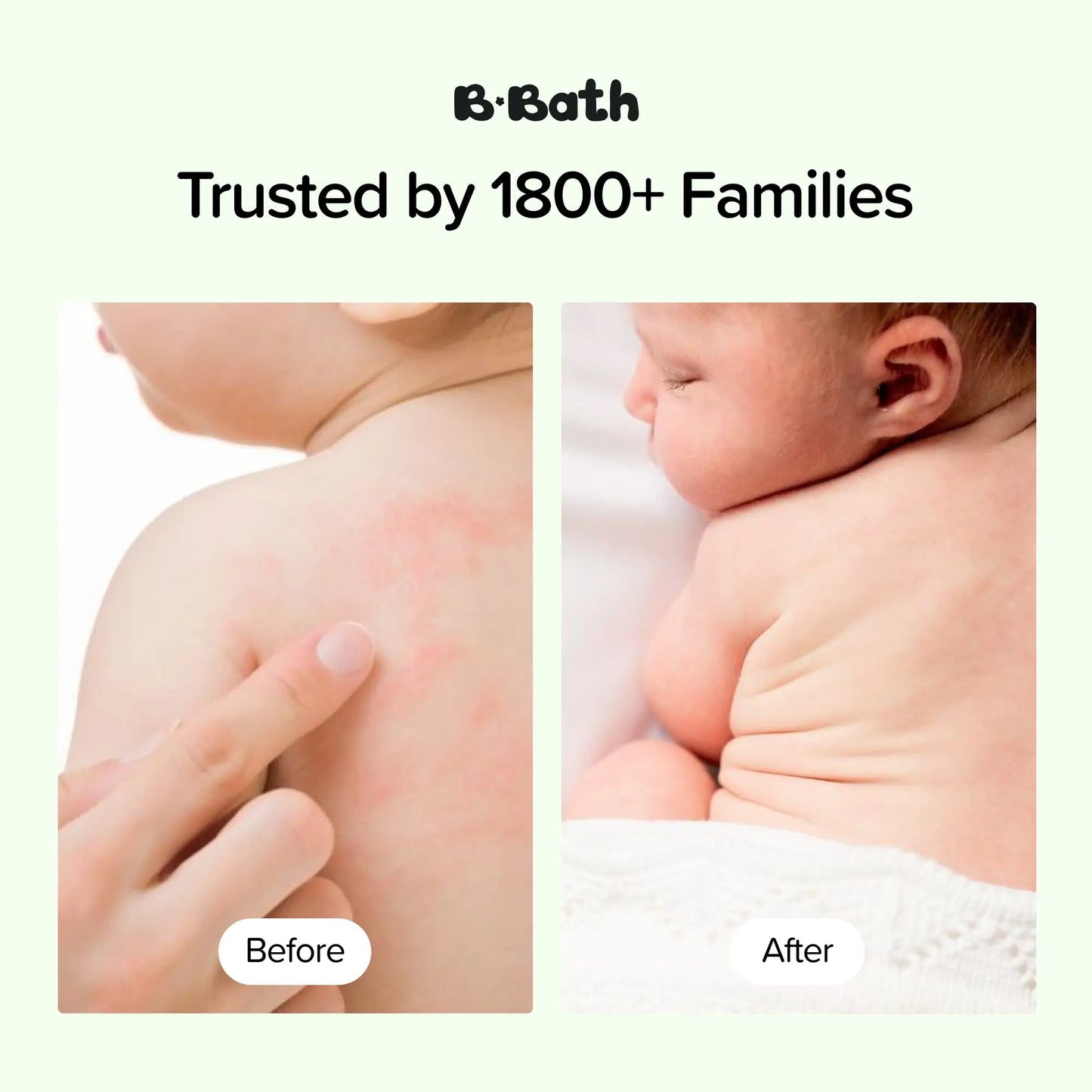 Comfort & Relief Lotion